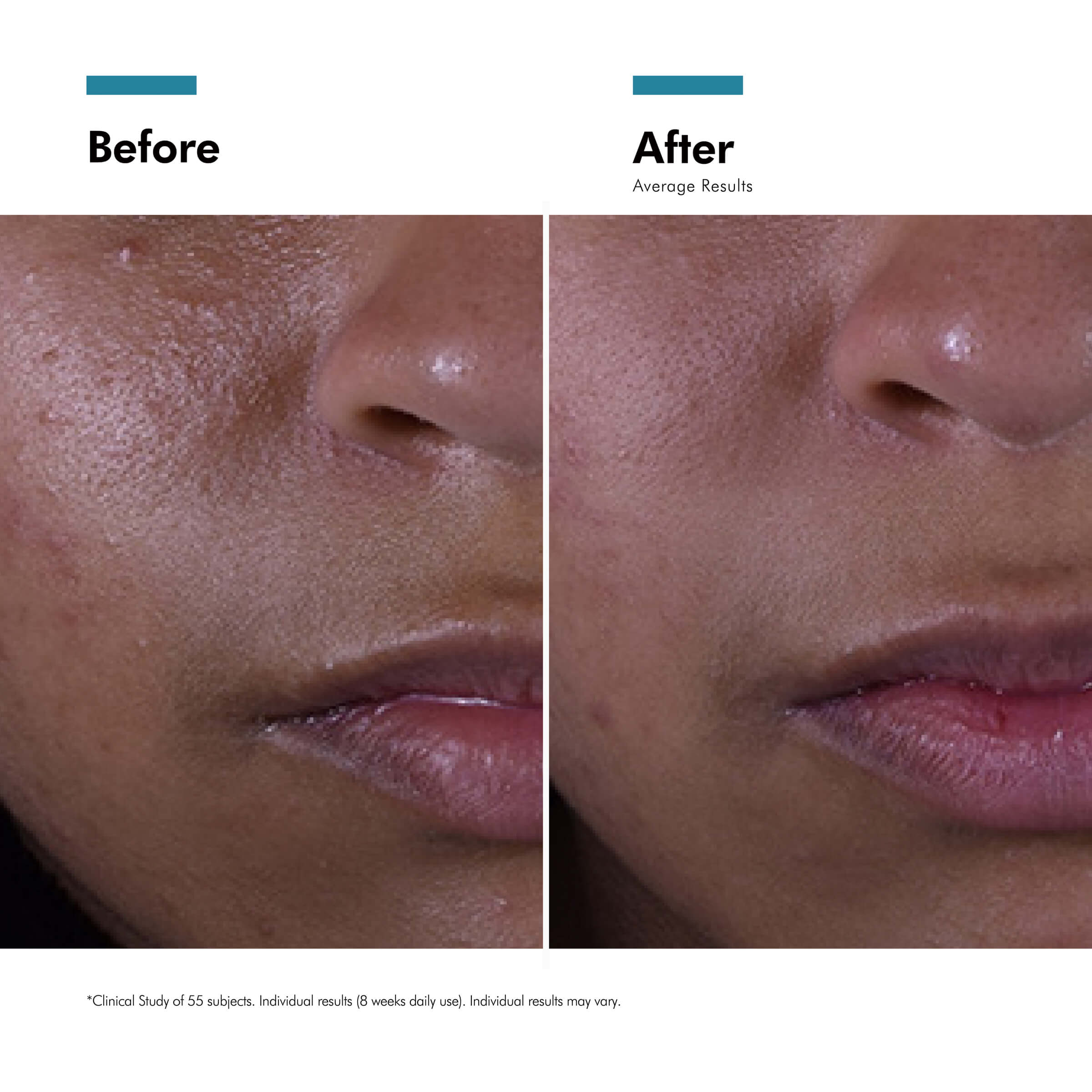 SkinCeuticals Silymarin CF SERUM 30ML