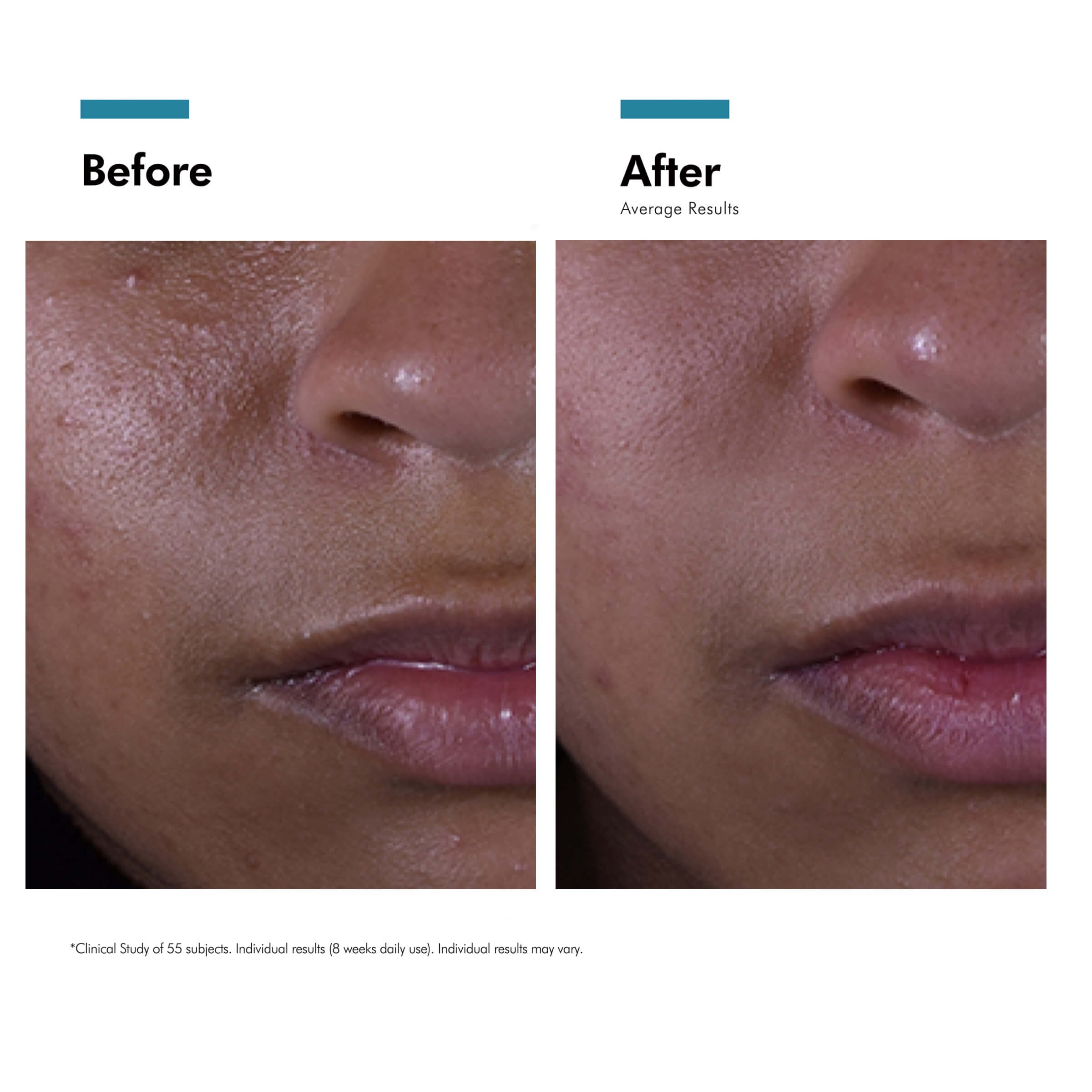 SkinCeuticals Silymarin CF SERUM 30ML