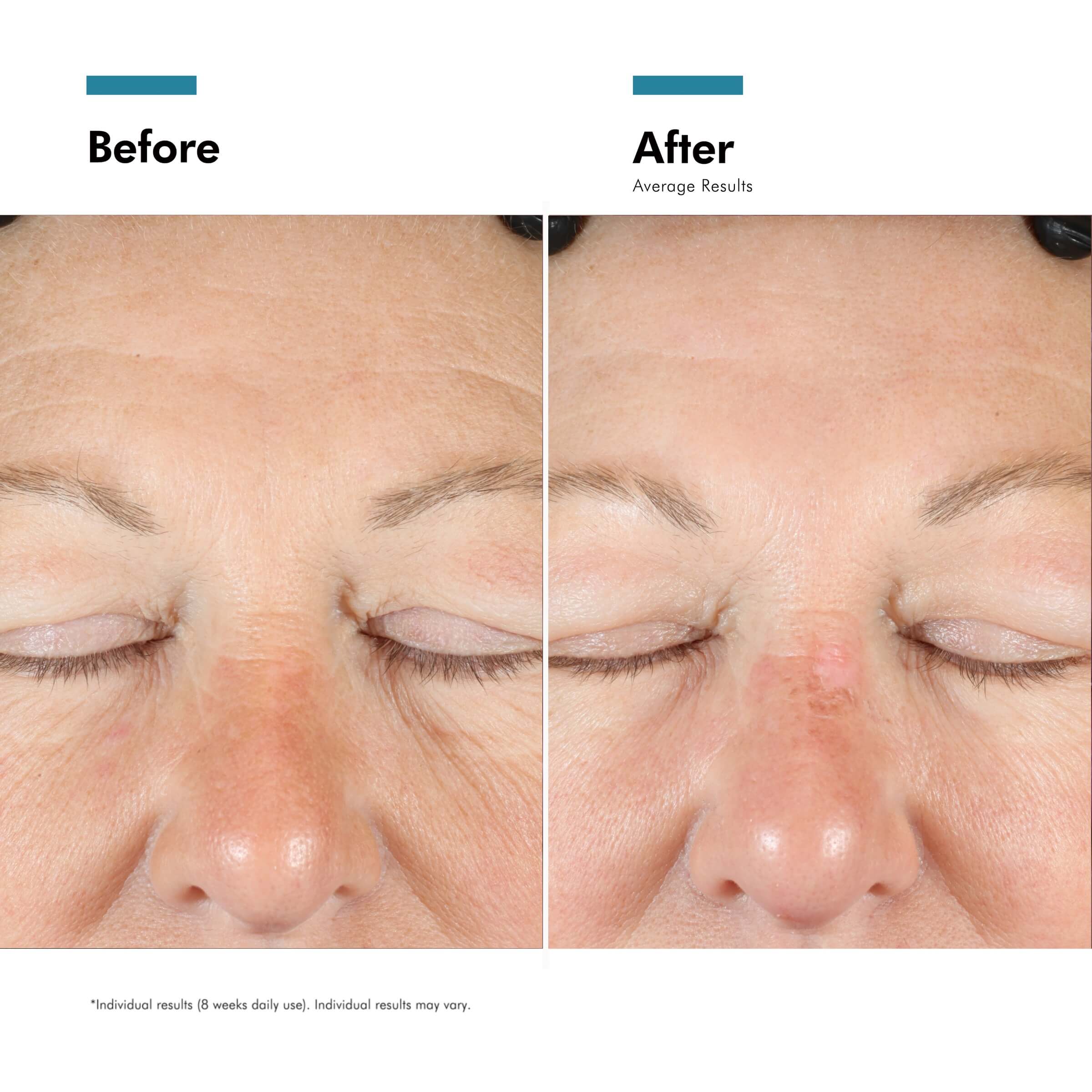 SkinCeuticals A.G.E. Interrupter Advanced 48ML