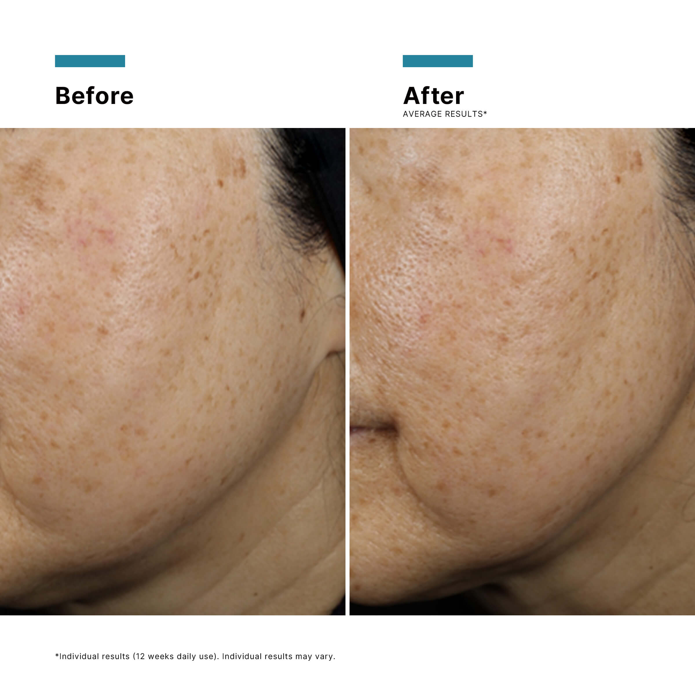 SkinCeuticals A.G.E. Interrupter Ultra Serum 30ml