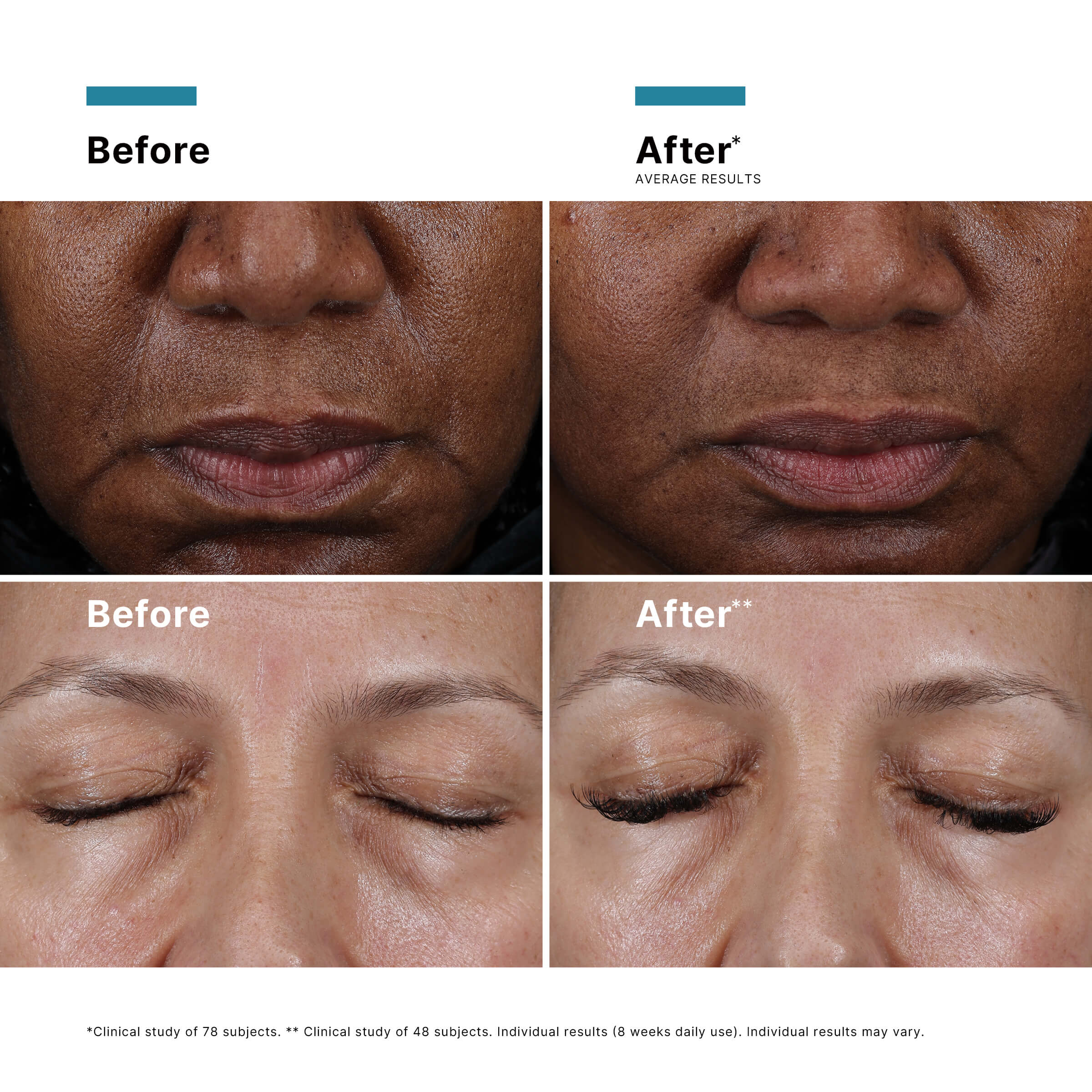 Skinceuticals Cell Cycle Catalyst Serum 30ml