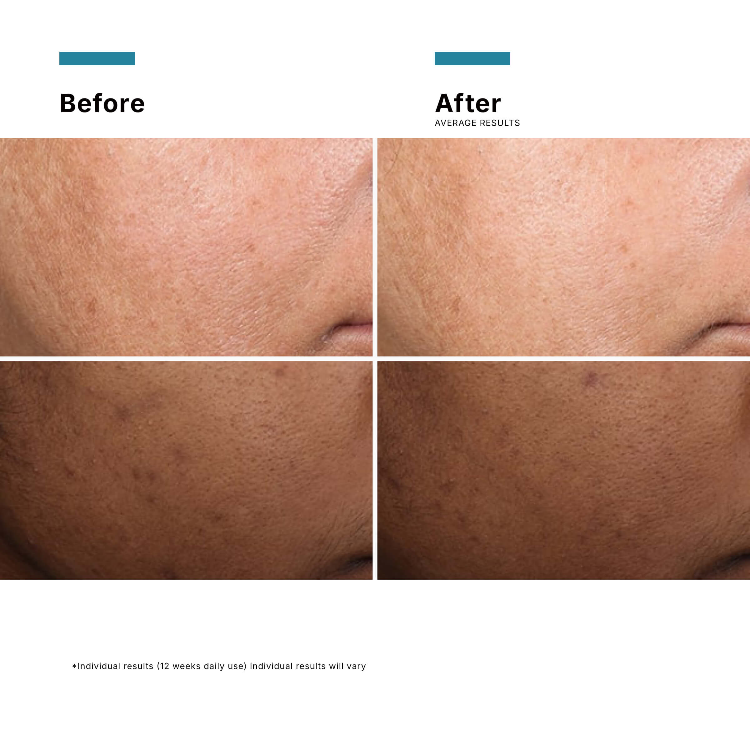 SkinCeuticals Discolouration Defense Serum 30ML