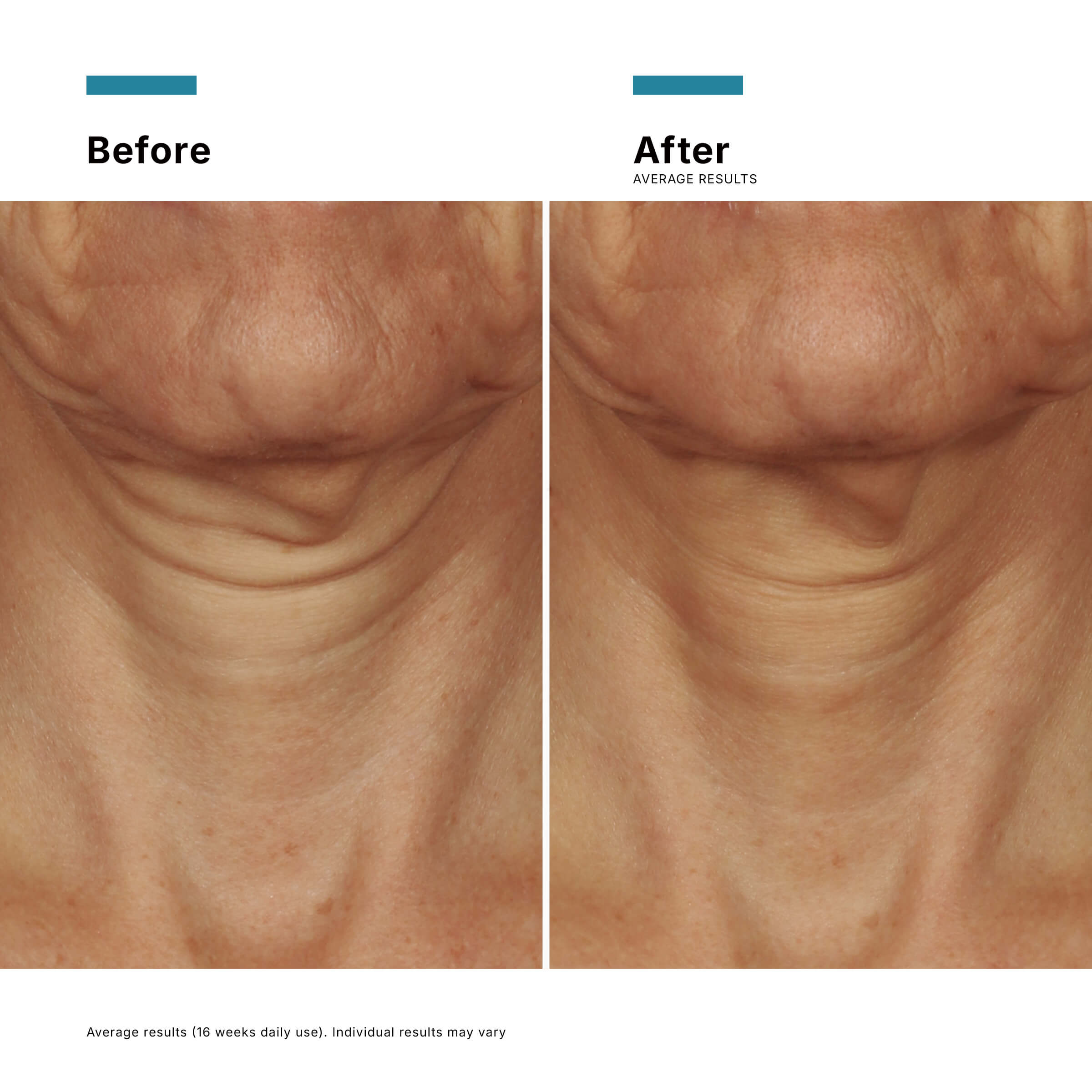 SkinCeuticals Tripeptide-R Neck Repair 50ML