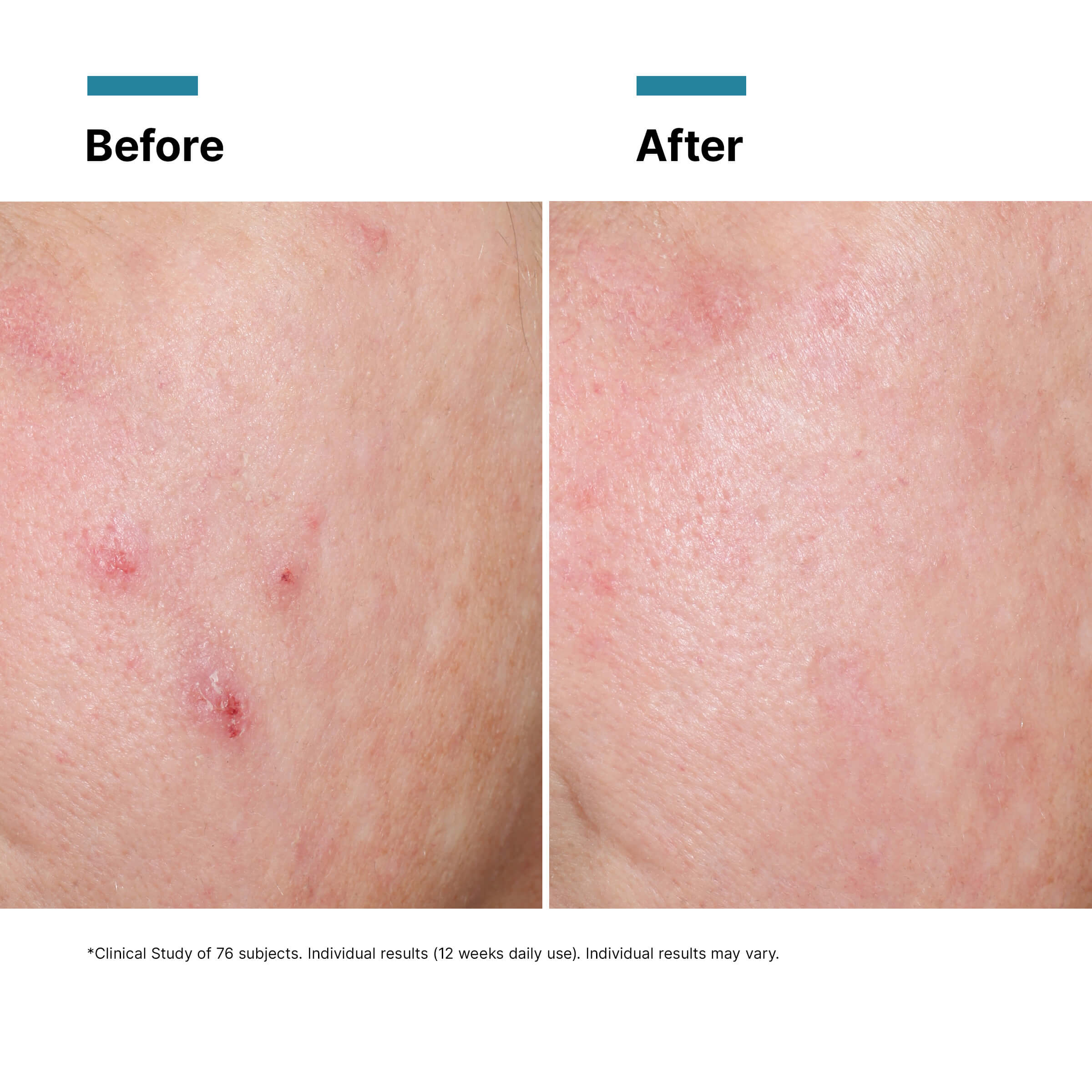SkinCeuticals Advanced RGN-6 Cream 50ml