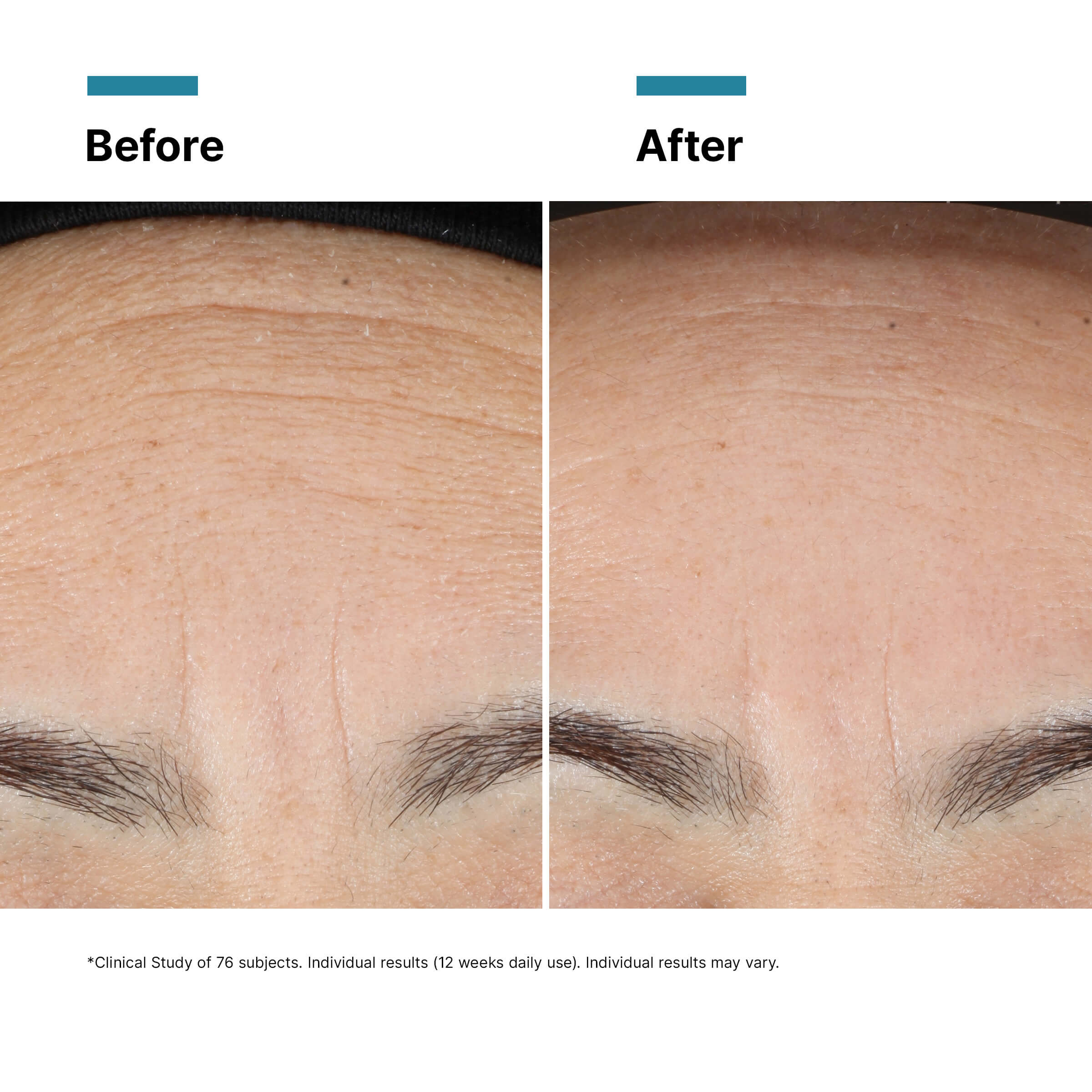 SkinCeuticals Advanced RGN-6 Cream 50ml