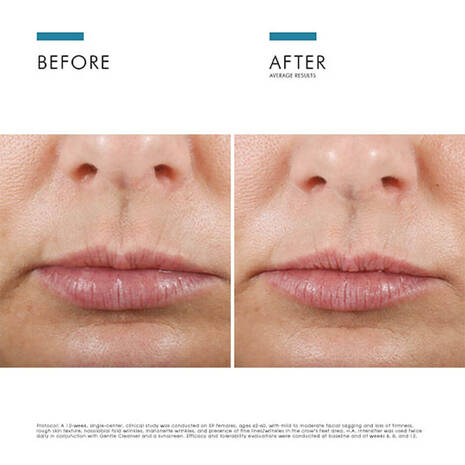 FREE GIFT SkinCeuticals H.A. Intensifier Multi-Glycan Serum 15ML.