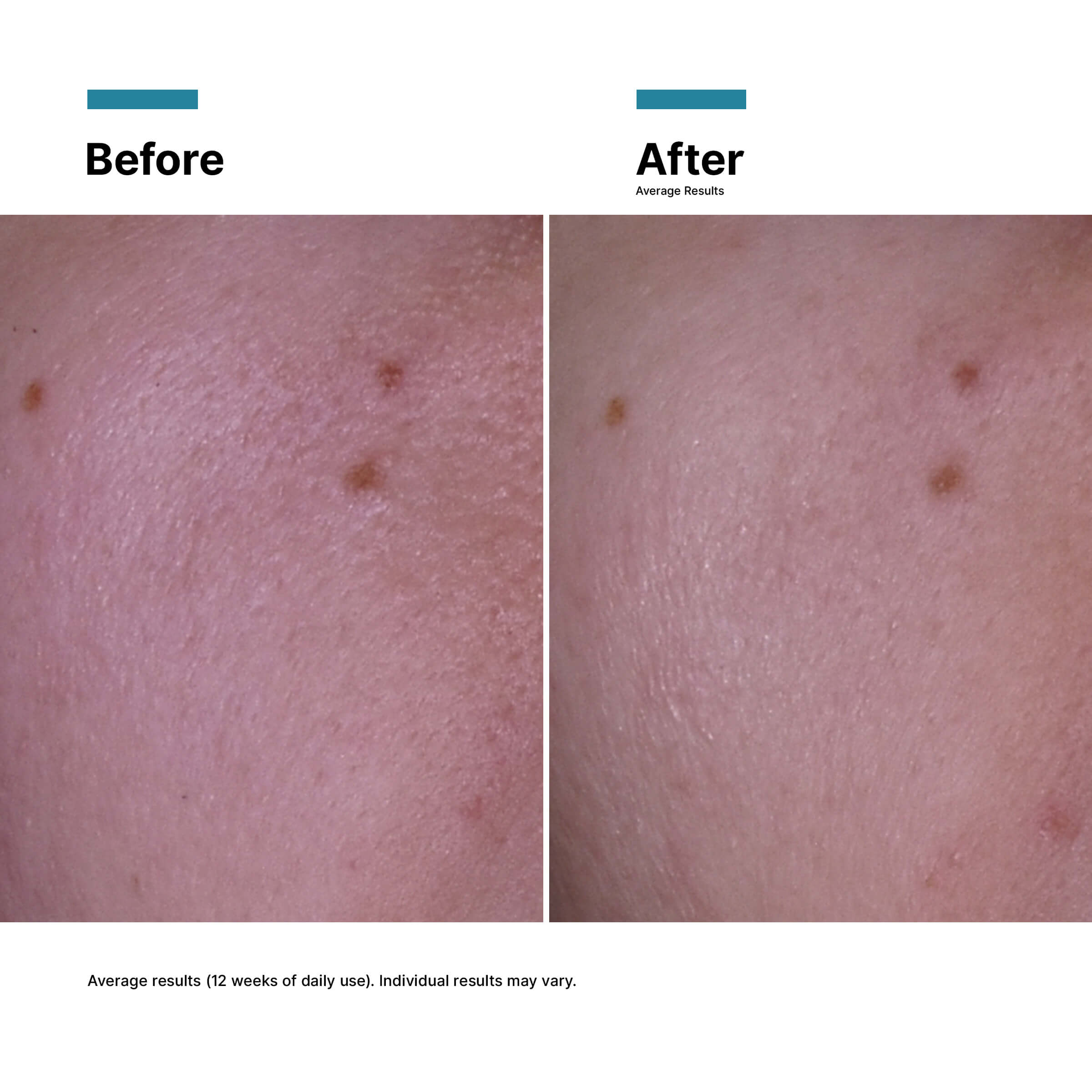 SkinCeuticals P-TIOX Cream - 48ml