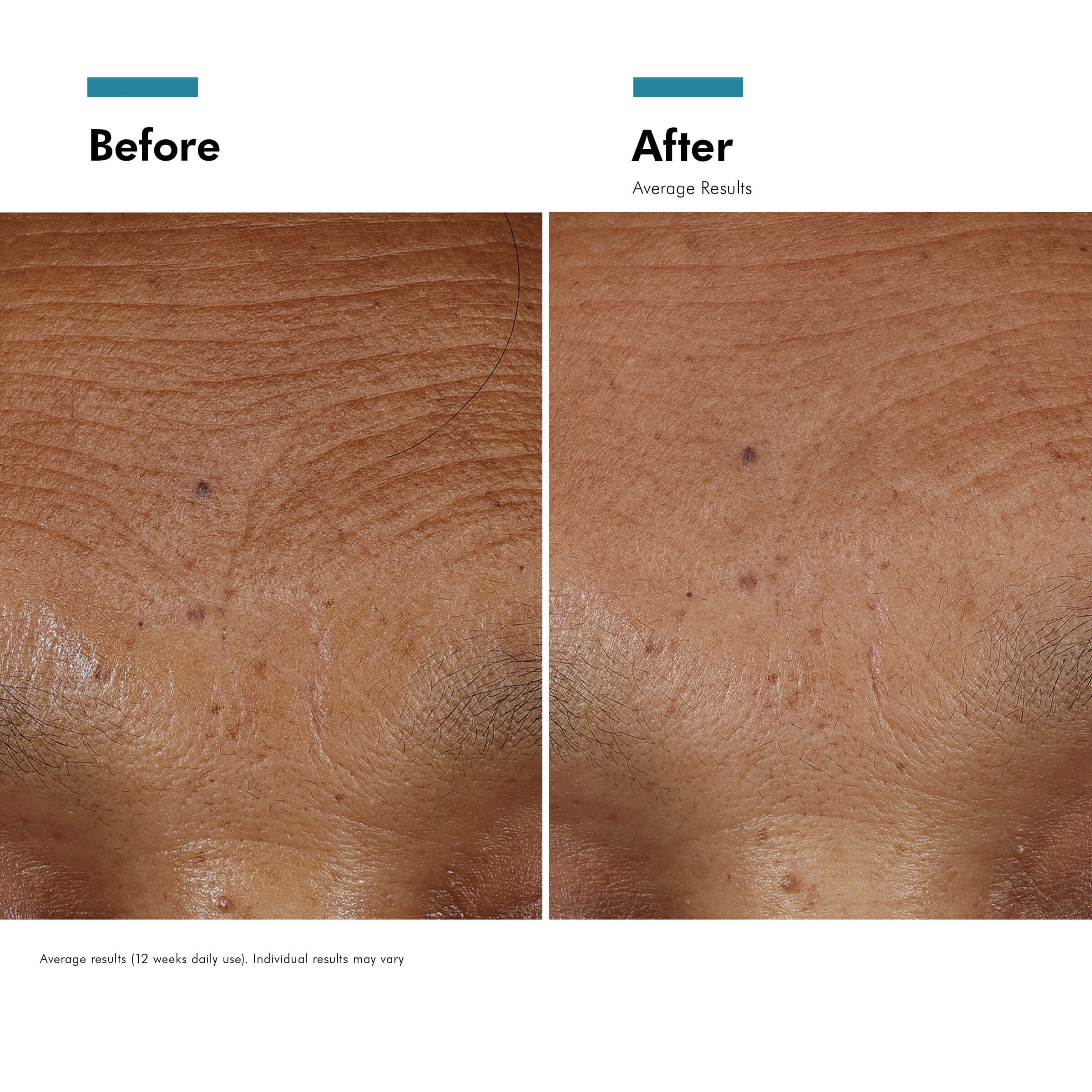 Skinceuticals H.A. Intensifier Multi-Glycan - 30ml