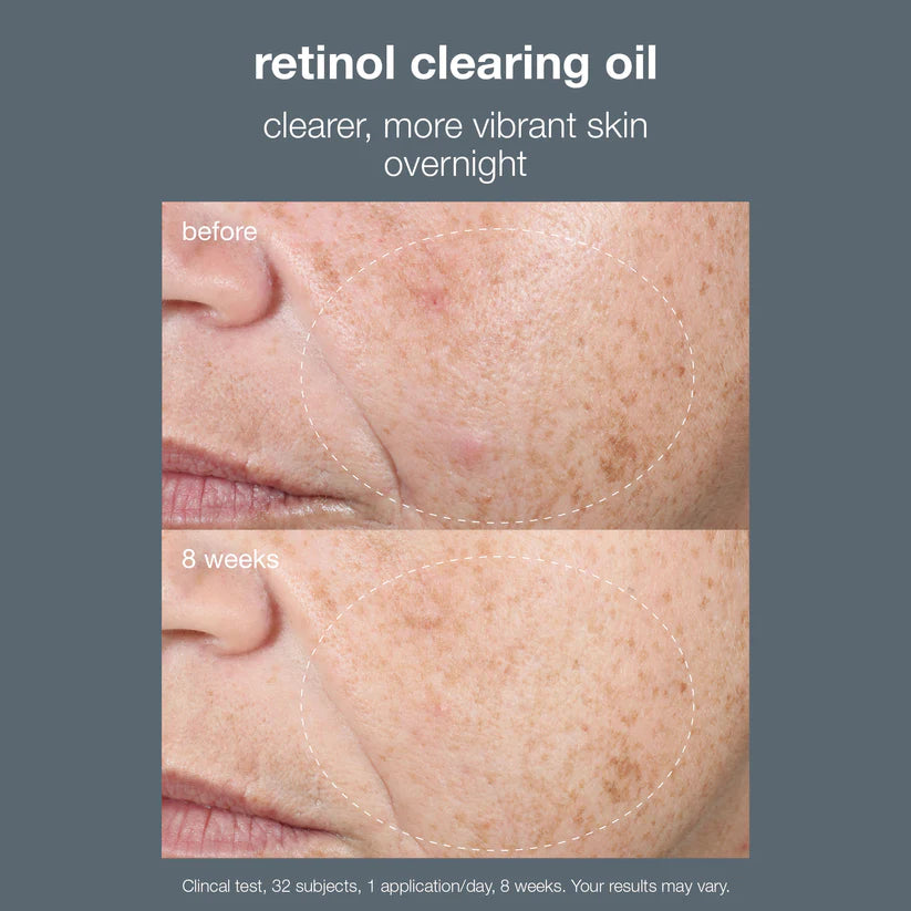 Dermalogica Retinol Clearing Oil 30ml - Active Clearing Night Oil